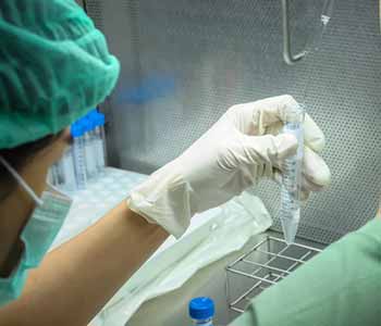 Sperm washing requires very little preparation.