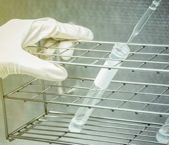 Preparing for a Semen Analysis in Dallas area