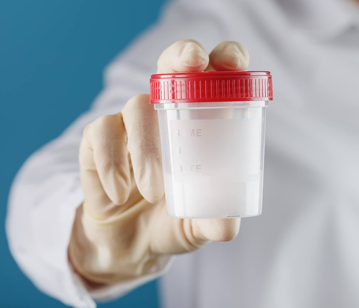 Sperm Storage Service at NTMIC Sperm Lab in Frisco Texas Area