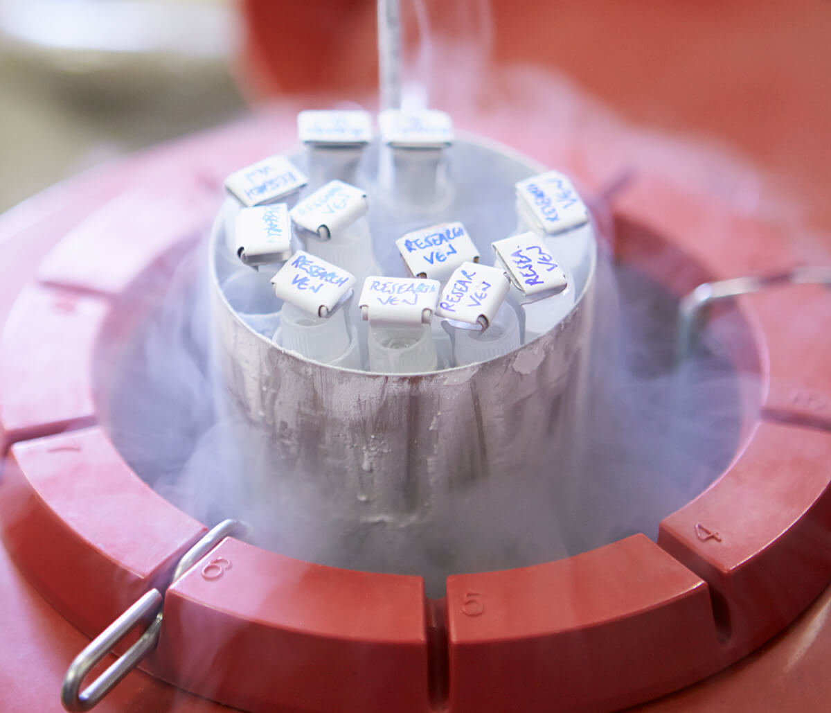 Patients Keep Options Open with State-of-the-art Sperm Banking in Frisco Area