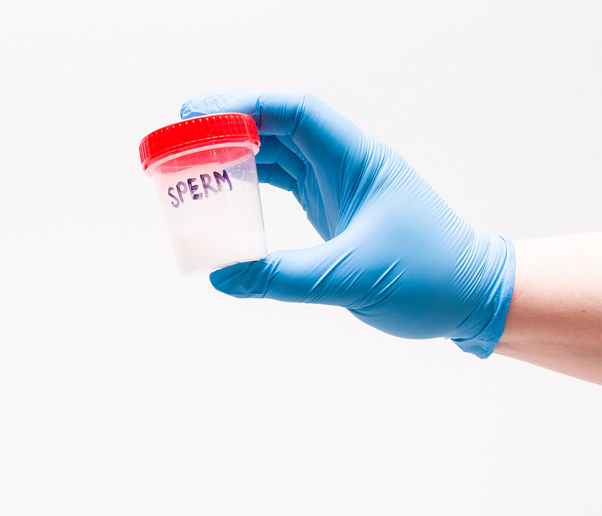 Sperm Collection and Storage in Frisco TX Area